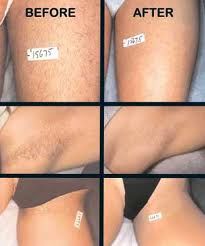 ALOHA ZEN INSTITUT BEAUTE BIEN ETRE