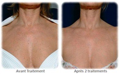 ALOHA ZEN INSTITUT BEAUTE BIEN ETRE