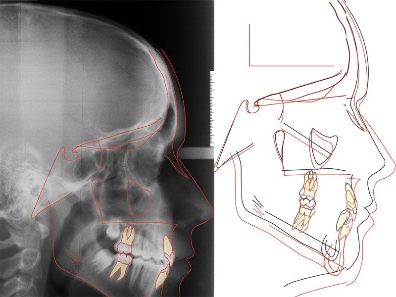Centre Médico-Dentaire Balexert Orthodontie