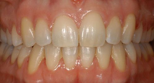 Centre Médico-Dentaire Balexert Orthodontie