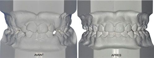 Centre Médico-Dentaire Balexert Orthodontie